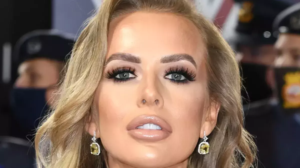 Faye Winter reveals transformation as she gets lip filler dissolved