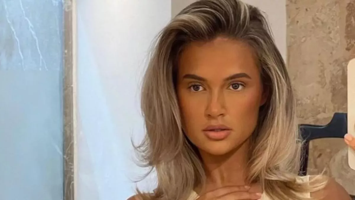 Molly-Mae: a skin condition that made her hide her arms for a year is back