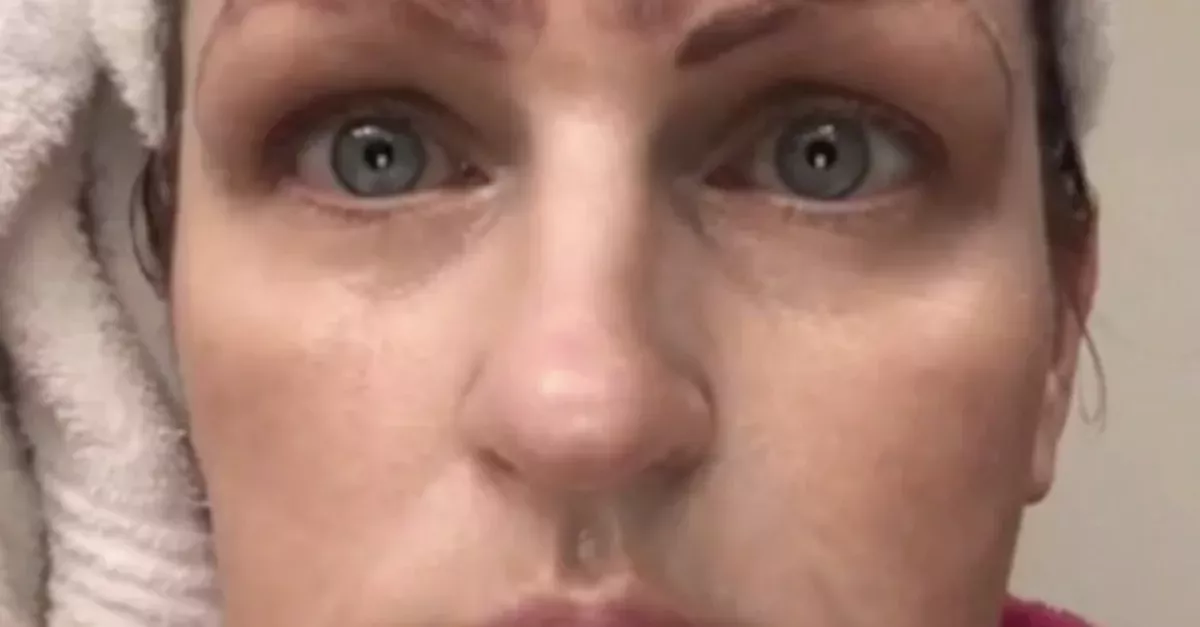 A botched microblading procedure left this woman with 4 eyebrows