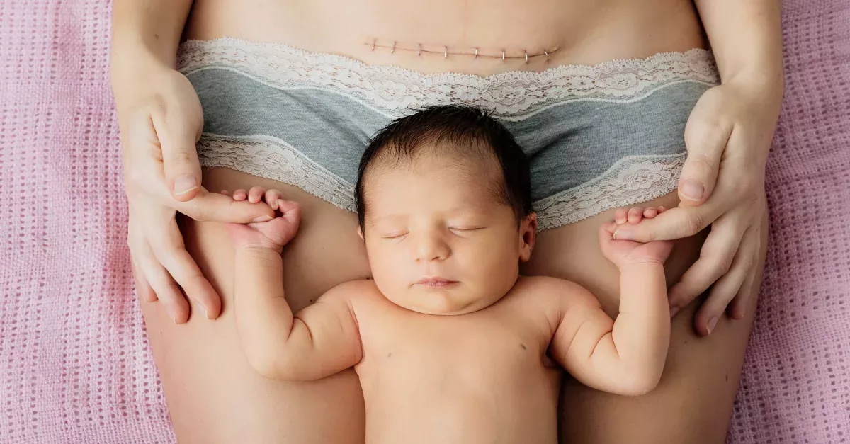 C-Section