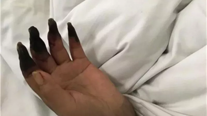 Her Hands Turned Black After Cleaning Her House.
