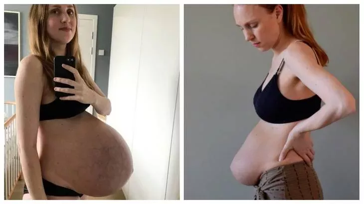 tummy