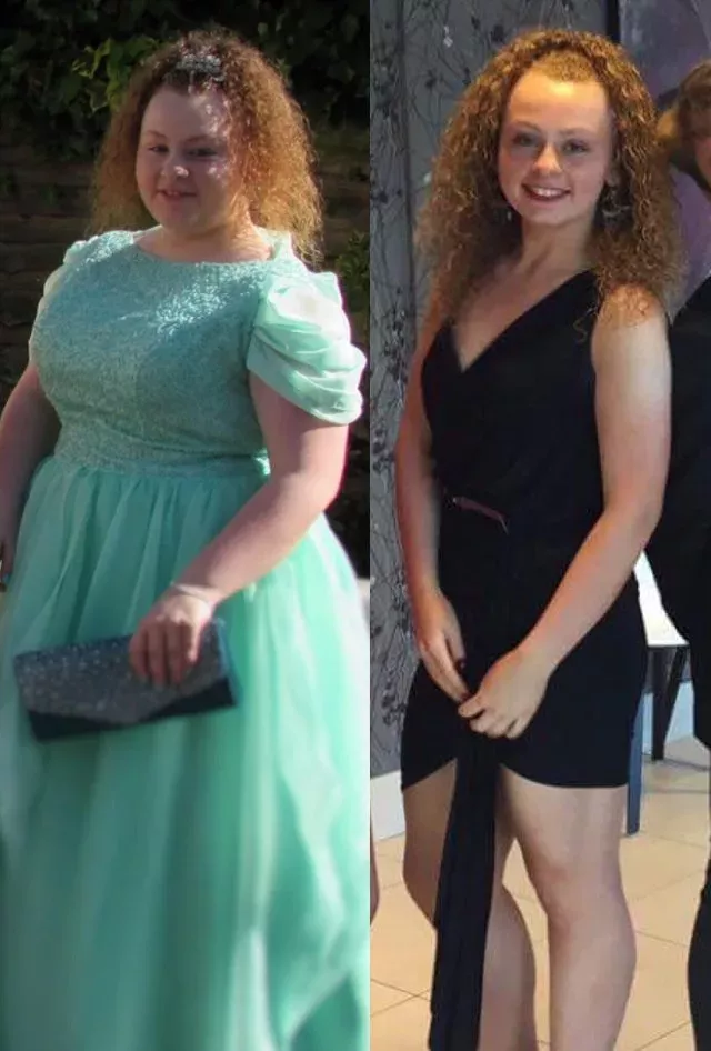 weightloss