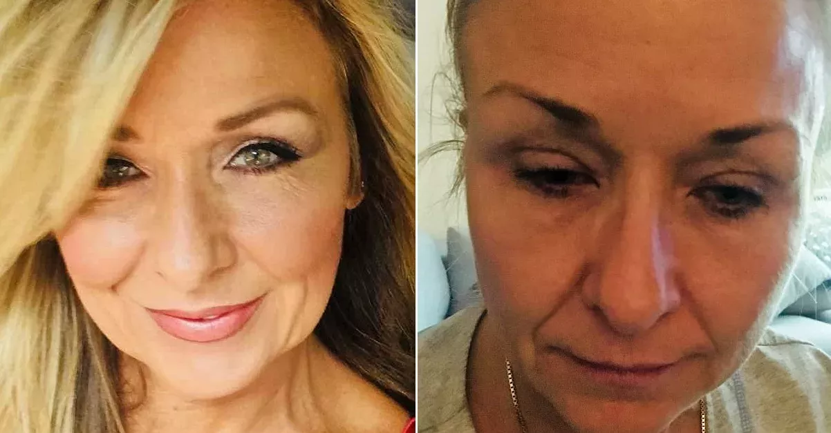 Woman Doesn't Remove Mascara For 25 Years