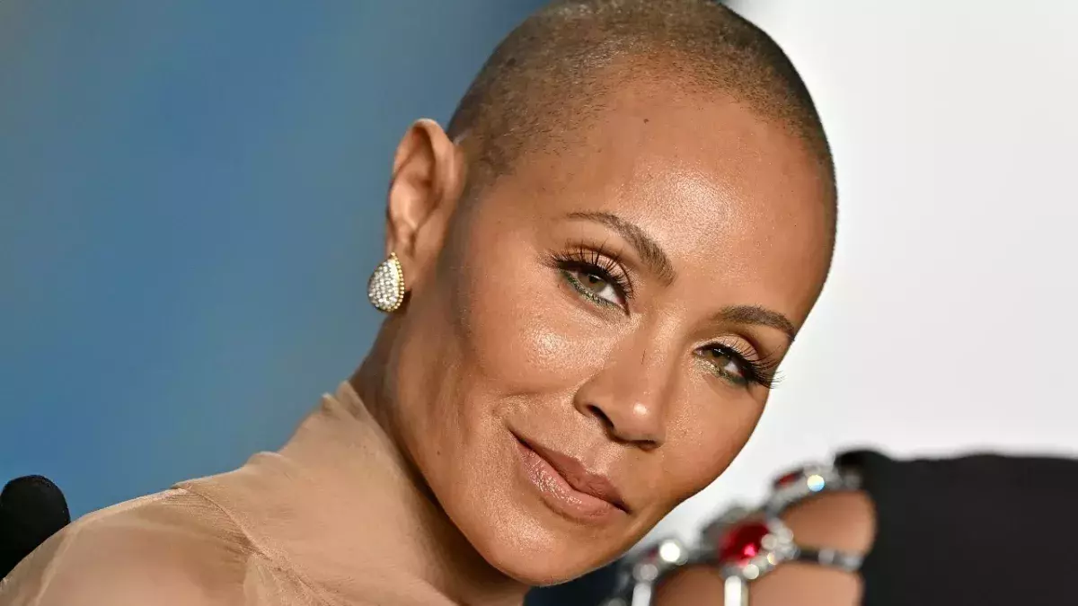 Alopecia