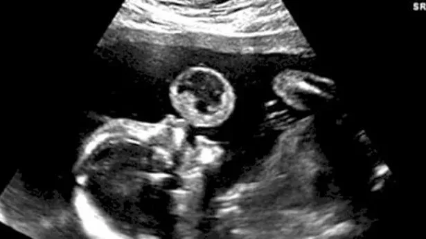 Baby Bubble