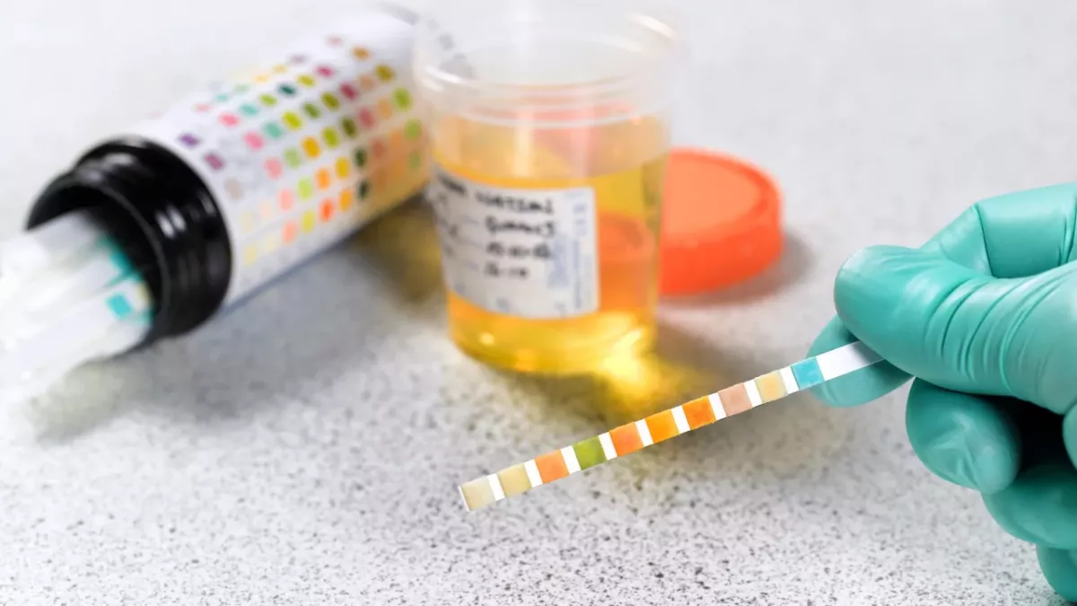 The colour of your urine reveals this about your health