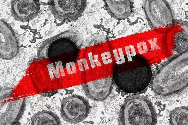 Monkeypox: This unexpected symptom has been revealed by a recent study 
