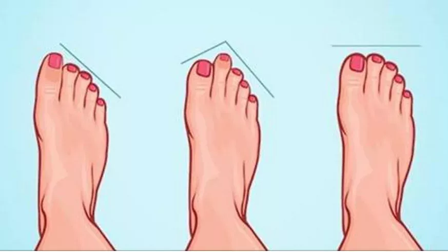 Foot shape