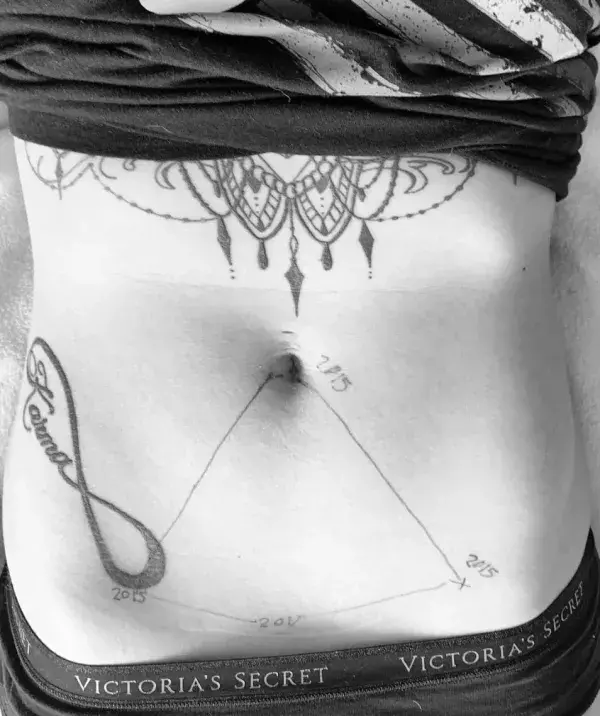 Anonymous photo sharing the marks of endometriosis on instagram thanks to the hashtag ‘this is endometriosis’