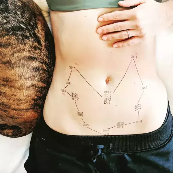 Anonymous photo sharing the marks of endometriosis on instagram thanks to the hashtag ‘this is endometriosis’